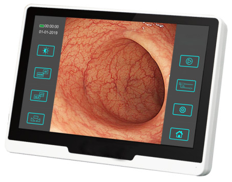 Diâmetro veterinário 2.8mm do equipamento médico do endoscópio flexível